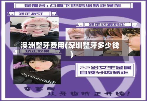 澳洲整牙费用(深圳整牙多少钱)-第2张图片